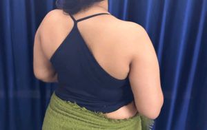 top