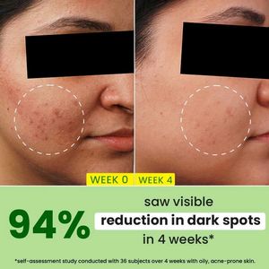 Dot &amp; Key Cica + 10% Niacinamide Face Serum 💚