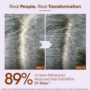 T.A.C. Rosemary Anti-Hair Fall Conditioner