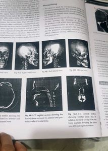 Odontogenic Tumours Textbook Chapter