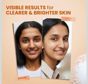 Sesa Brightening and Tan Removal Soap