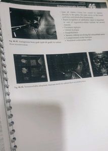 Odontogenic Tumours Textbook Chapter