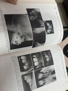 Orthodontics Principles and Practice Textbook