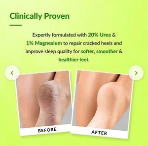 Fixderma Foot Roll On