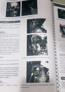 Odontogenic Tumours Textbook Chapter