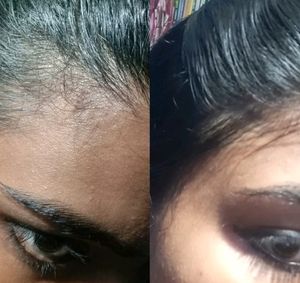 Homemade Secret Herbal Hairgrowth Oil