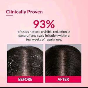 Fix DERMA Bioteez-S Anti-Dandruff Shampoo