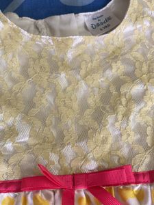 Bright Yellow Cute Frock