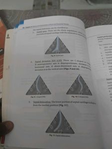Practical ENT 4th Edition by Vikas Sinha