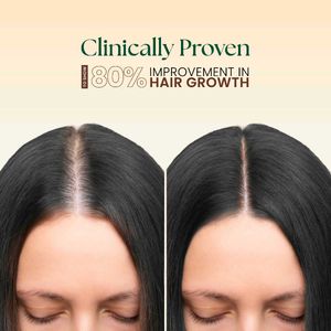 Moha 5 in 1 Hair Oil
