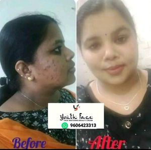 Check Results 😍Youth Face Whitining Cream