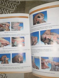Preclinical Manual of Prosthodontics Textbook