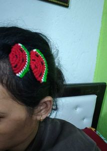 Cute Watermelon Hair Clips