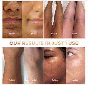 Niconi Tan Vanish Gluta-Kojic Skin Polish