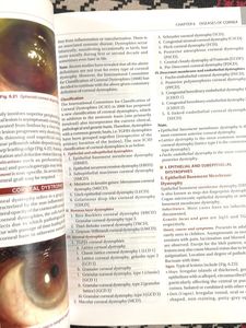 Khurana Ophthalmology