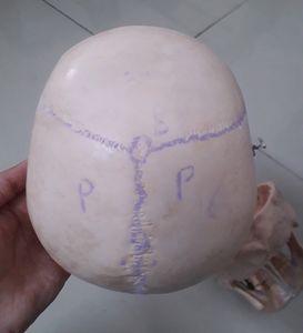 Human POP Skull (For Medical 1st Years)!!👍
