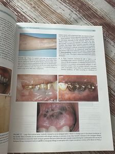 Phillips' Science of Dental Materials