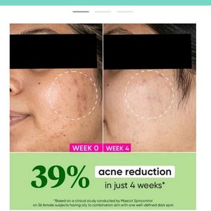 Niacinamide Night Gel And Vitamin C Moisture