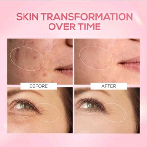 RENEE Pink Therapy Serum❤