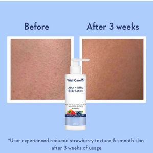 WishCare Body Lotion for bummy skin