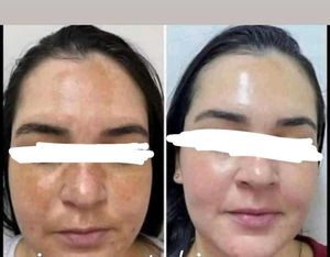 Brightening Yellow Face Cream Jars
