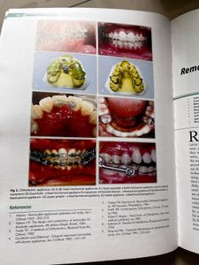 Orthodontics: The Art and Science