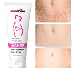 SmartDrops Mango Stretch Mark Cream
