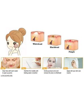 blackheads removal kit