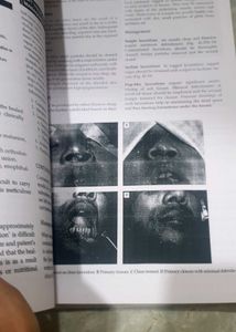 Odontogenic Tumours Textbook Chapter