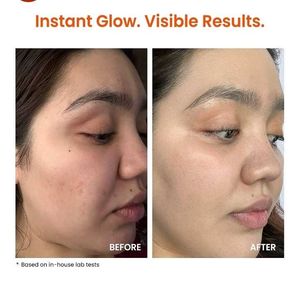 Foxtale Super Glow Moisturizer