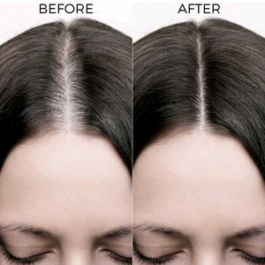 Brillare Rosemary Oil Shots Rapid Hair Growth | Im
