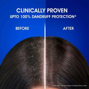 Head Shoulder Anti Dandruff Shampoo 1 Litre