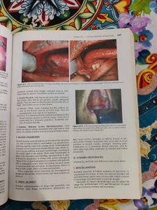 Diseases of Ear, Nose and Throat ENT MBBS BOOK