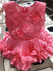 kids frock