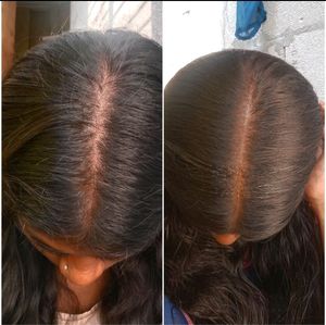Homemade Secret Herbal Hairgrowth Oil