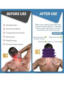 Neck Traction Device for Pain Relief