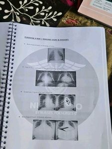 Nursing norcet,rrb,chc,phc notes
