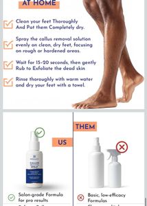 MANNLICH Callus Remover Spray