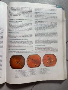 Parsons' Eye: Diseases of the Eye - 23rd Edition