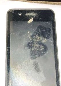 display mobile phone glucometer