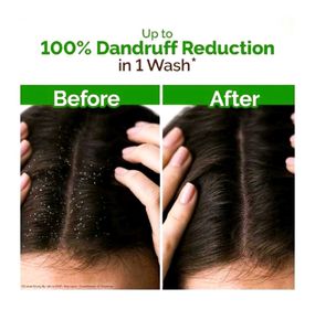 Mamaearth Lemon Anti-Dandruff Shampoo sale offer ?