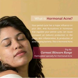Carmesi Pore-Clarifying Toner for Hormonal Acne