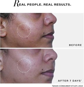 Novology Acne Deep Clearing Cleanser