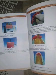 Preclinical Manual of Prosthodontics Textbook