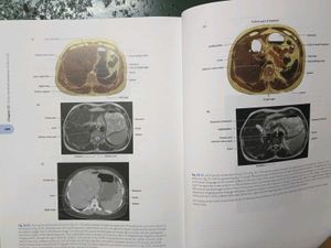 Cunningham's Anatomy Books (Set of 3)
