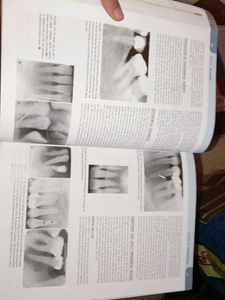 Oral Radiology Dentistry book BDS Dental Radio