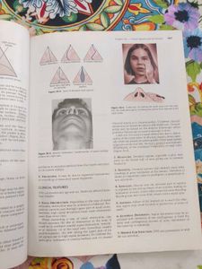 Diseases of Ear, Nose and Throat ENT MBBS BOOK