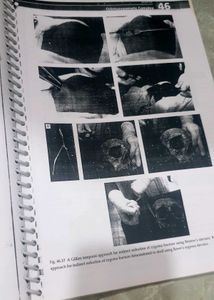 Odontogenic Tumours Textbook Chapter