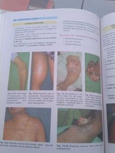 Manipal Manual of Surgery, 2nd Edition