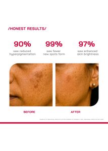 PHD 2% Alpha Arbutin Depigmentation Serum